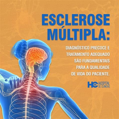 o que é esclerose multipla diagnostico|como prevenir la esclerosis multiple.